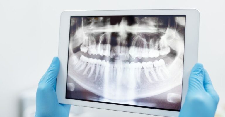 Dentysta wykonujący cyfrowy skan zębów pacjenta w klinice stomatologicznej